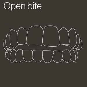 open-bite-outline