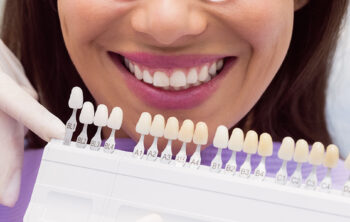 From Stained to Stunning: How Dental Veneers Can Whiten Your Teeth